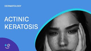 Actinic Keratosis Dermatology [upl. by Terris598]