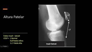 Webinar Actualización en ortopedia y traumatologÍa [upl. by Landry]