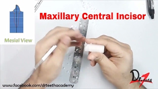 Carving the Maxillary Central Incisor [upl. by Shoshanna]