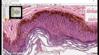 Keratinized stratified squamous epithelium [upl. by Tnias]