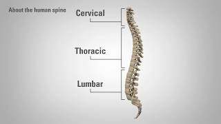 Radiculopathy  Patient Education [upl. by Irrek]