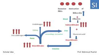 Hemolytic hepatic and obstructive Jaundice explained [upl. by Nuj977]