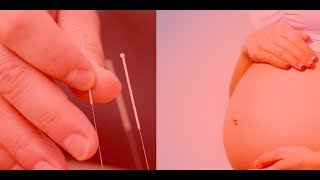 Pregnancy amp Acupuncture [upl. by Danaher]