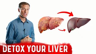 A Surprising Way To Cleanse Fatty Liver – Dr Berg On Liver Detoxification [upl. by Naves]