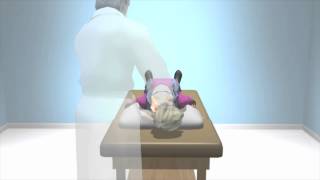 Dix Hallpike to Diagnose BPPV Dizziness [upl. by Adnorhs512]