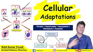 Cell adaptation pathology  Hyperplasia Hypertrophy Atrophy Metaplasia and Dysplasia [upl. by Devaj]