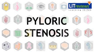 Pyloric Stenosis [upl. by Ahsikrats637]