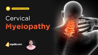 Ulnar Nerve Entrapment mimicking C8 Radiculopathy [upl. by Sevy]