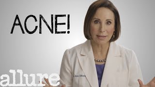 What is Acne and How Do I Get Rid of it Forever  Allure [upl. by Hauck]