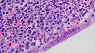 Leukocytes in histology [upl. by Devon]