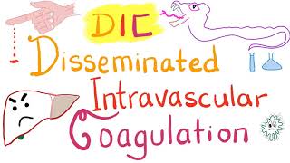 Disseminated Intravascular Coagulation DIC [upl. by Sum638]