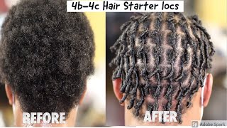 💋Learn how to  Starter Locs on 4b4c Hair [upl. by Bethesde171]