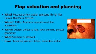 11 Facial flaps The Basics [upl. by Eveiveneg]