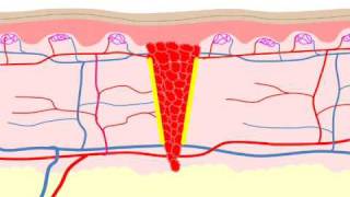 Wound Healing [upl. by Nylessoj204]