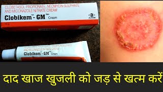 Clobikem Gm Cream Uses in Hindi [upl. by Etterb273]